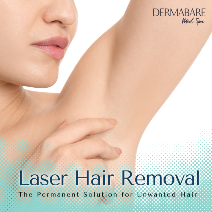 Hair removal